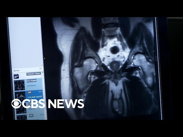 CBS News