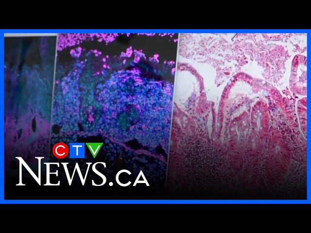 CTV News